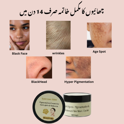 Anti Pigmentation Dark Spots Beauty Cream
