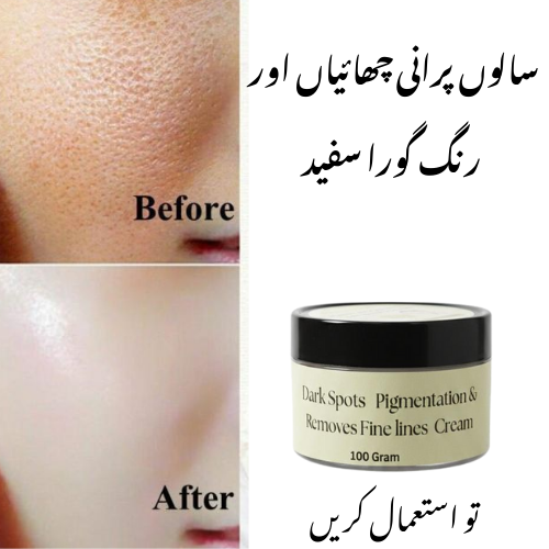 Anti Pigmentation Dark Spots  Beauty Cream