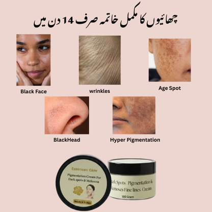 Anti Pigmentation Dark Spots  Beauty Cream